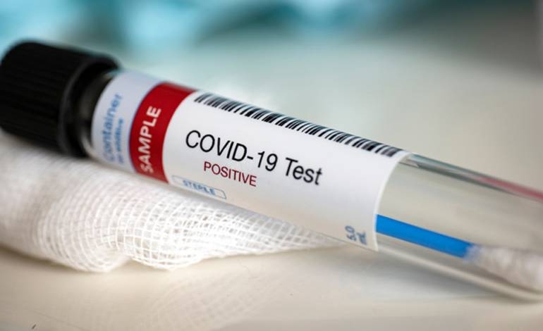They report 55 cases of COVID-19 and a new deceased