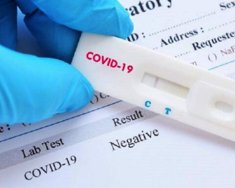 Demand for 'rapid covid tests' grows due to the centralization of the Minsa