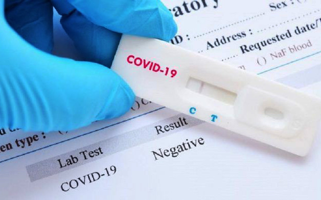 Demand for 'rapid covid tests' grows due to the centralization of the Minsa