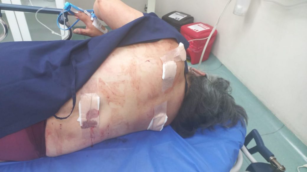 Woman was stabbed in attempted robbery in Chaquiñán