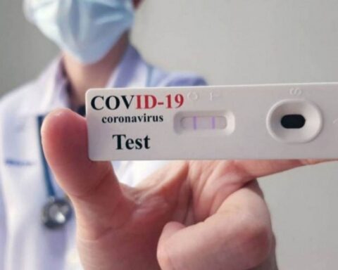 In less than a month, Argentines have bought almost 20,000 coronavirus self-tests