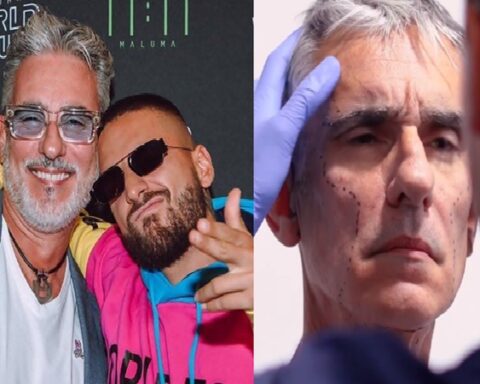 This is how Miguel Varoni looks after his cosmetic surgery, did he look like Maluma?