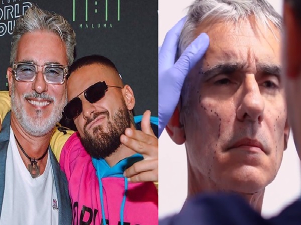 This is how Miguel Varoni looks after his cosmetic surgery, did he look like Maluma?