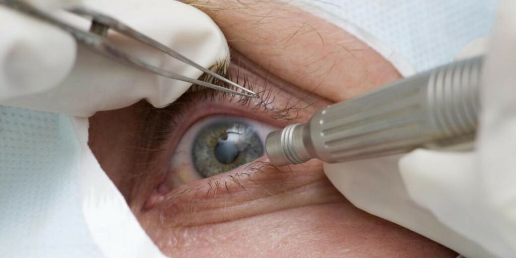 Council warns of importance of care in ophthalmic efforts