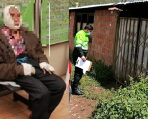 Elder denounces that a couple burned his face and genitals to take his money in Cusco