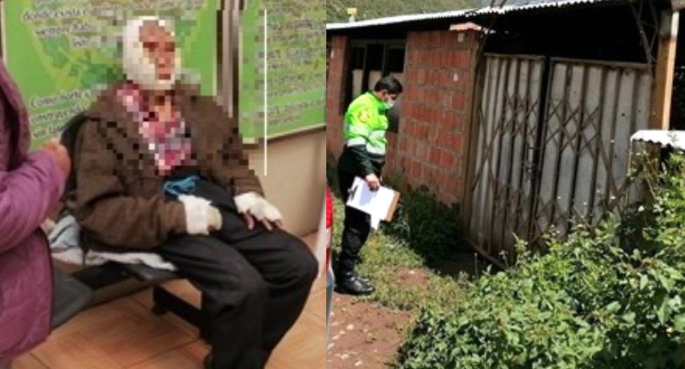 Elder denounces that a couple burned his face and genitals to take his money in Cusco