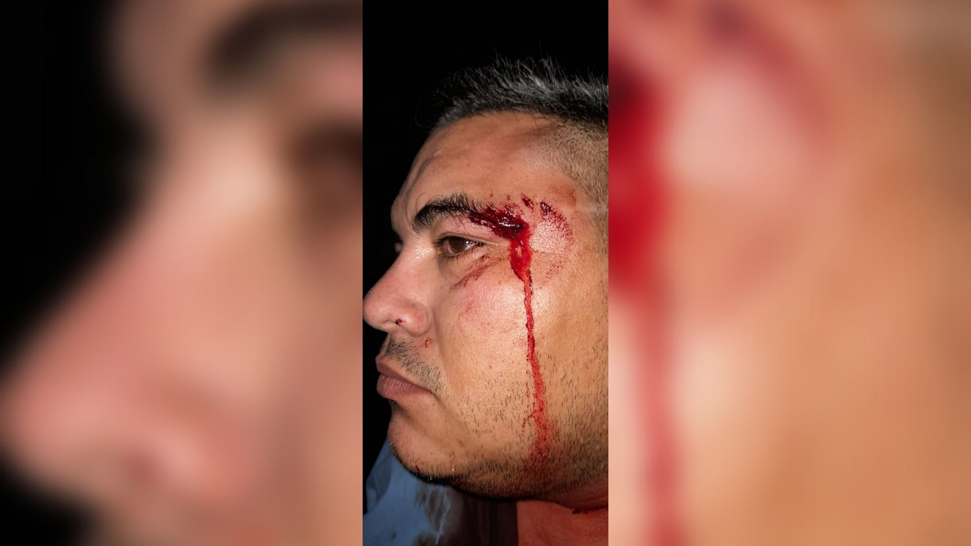 Nicaraguan doctor goes into exile after being beaten by Ortega supporters