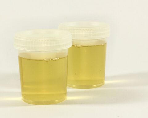 Human urine, a less polluting fertilizer