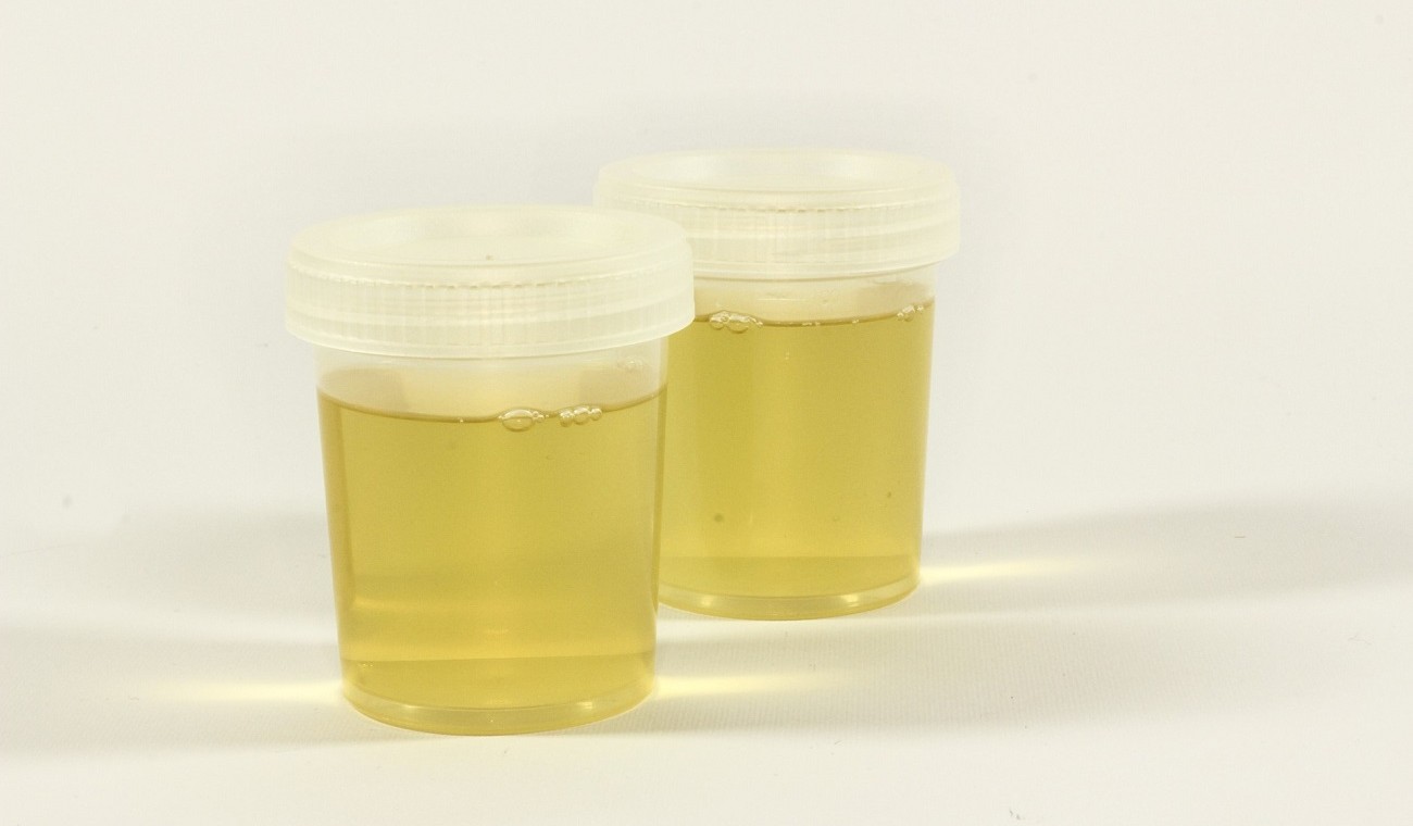 Human urine, a less polluting fertilizer