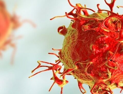 In 30 years, the diagnosis of the most frequent leukemia in men increased by 35%