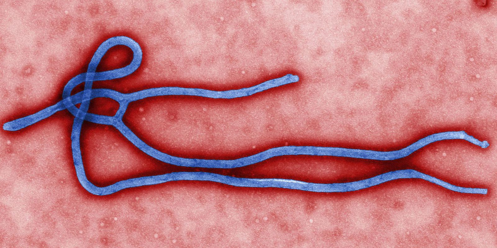 New Ebola outbreak hits the Democratic Republic of Congo