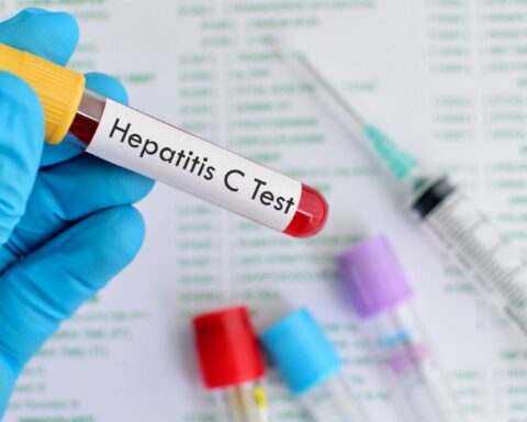 The ANMAT approved a rapid test for the detection of hepatitis C