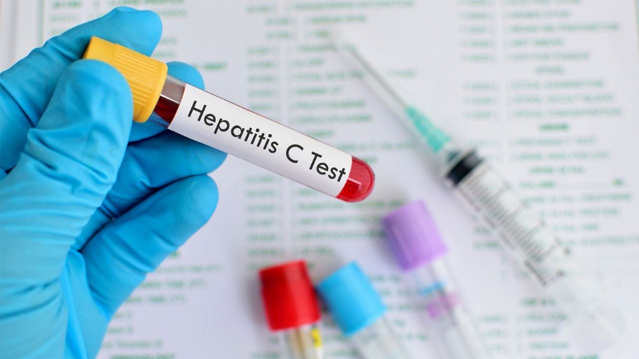 The ANMAT approved a rapid test for the detection of hepatitis C