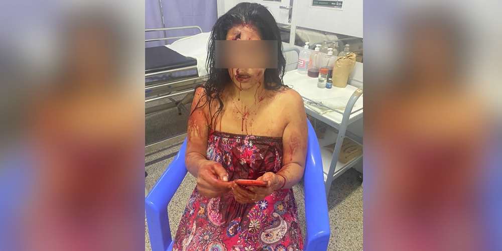 Woman is miraculously saved after being attacked with a knife by her concubine