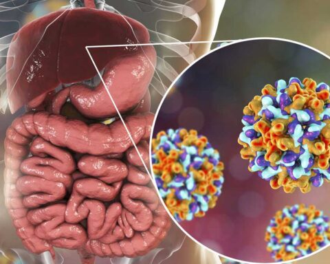 Acute hepatitis: the cause of the disease has not yet been identified