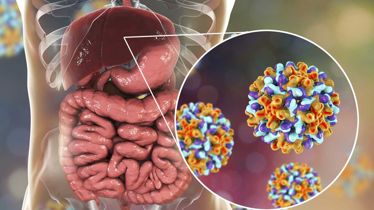 Acute hepatitis: the cause of the disease has not yet been identified