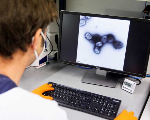 Un científico observa el virus de la viruela del mono en un laboratorio. Foto: LUKAS BARTH/ REUTERS, vía RTVE.