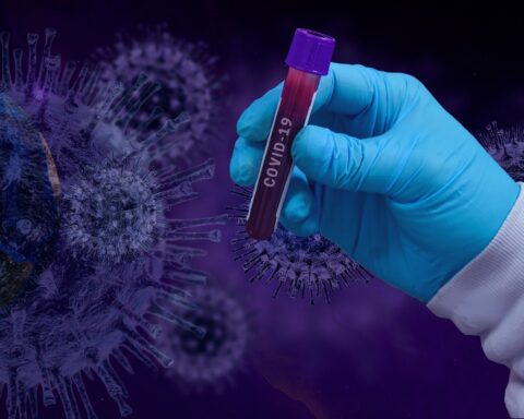 In the week there were 8916 new cases of COVID and 28 deaths in the country