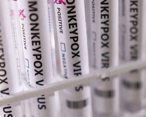 Ministry of Health confirms 8th case of monkeypox in the country