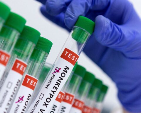 São Paulo confirms second case of monkeypox