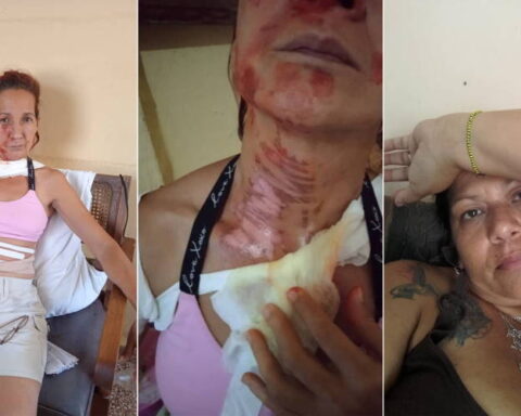 Croquetas, Bauta, Cuba