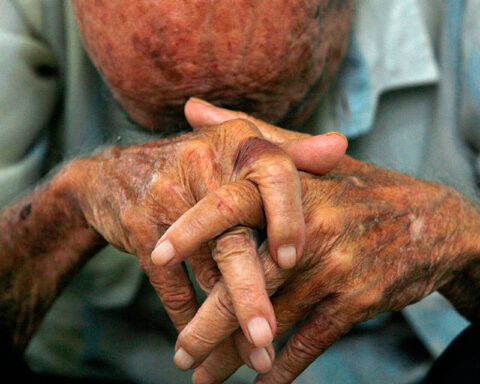 Convite: "Only 1% of the population of older adults can access insurance policies"