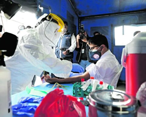 First possible case of monkeypox reported in Cusco