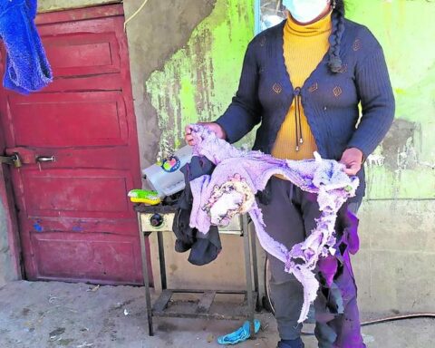 Gas deflagration burns 15 thousand soles and leaves mother and children with serious burns