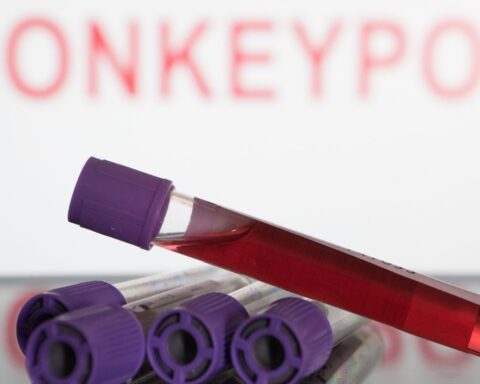 Medical societies warn of monkeypox care