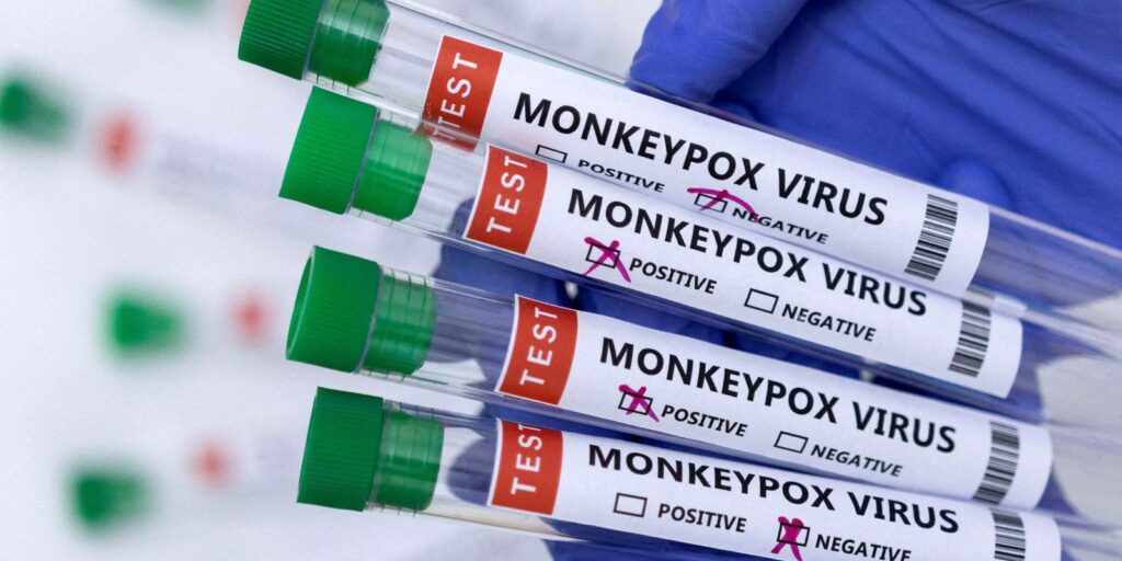 Monkeypox cases reach 76 nationwide