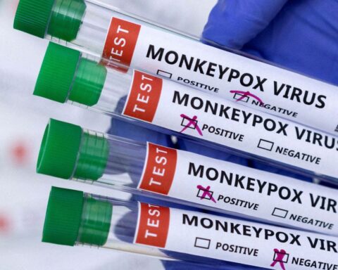 Monkeypox cases reach 76 nationwide