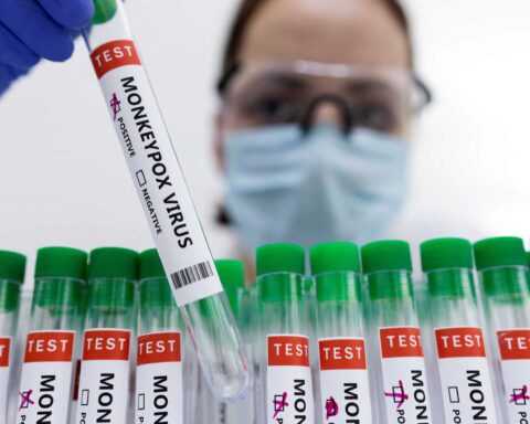 PAHO rules out mass vaccination for monkeypox