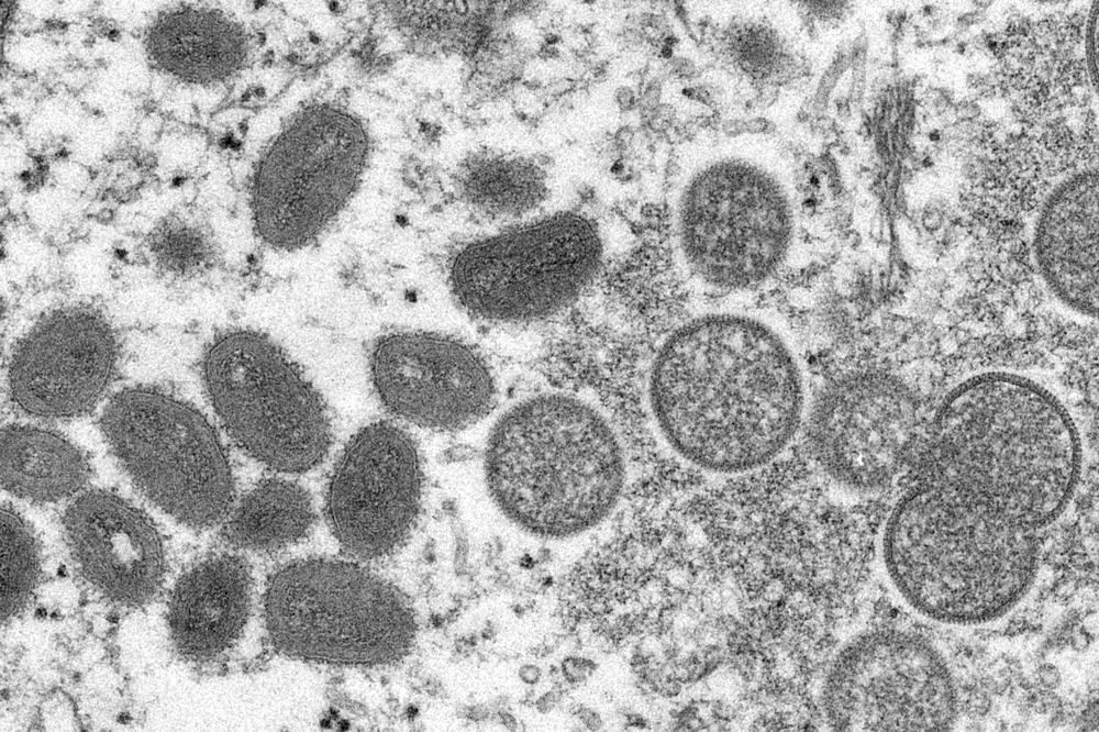 Vista microscópica del virus de Viruela del Mono. Foto: Cynthia S. Goldsmith, Russell Regner/CDC, vía AP, Archivo.