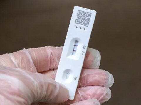 Hay 673 nuevos casos de Covid-19