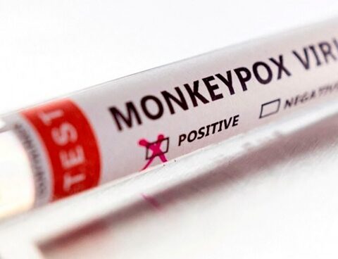 Thirteen confirmed cases of monkeypox in the country