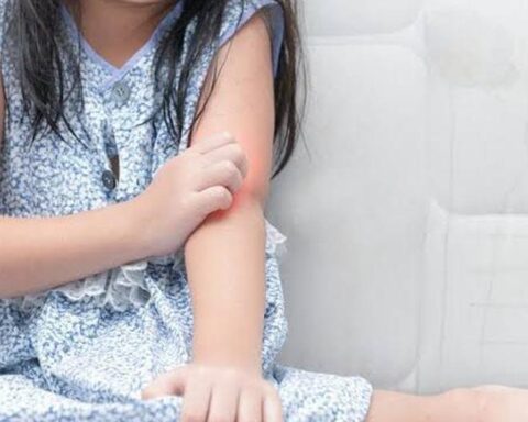 Atopic Dermatitis: Association that provides support to patients highlights the importance of upbringing free of prejudice