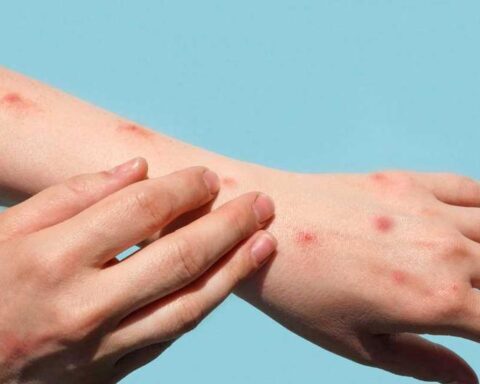 Carrier who tested positive for monkeypox was located after giving a false address