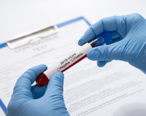 During the week, 1,925 new cases of COVID were detected and there were 10 deaths