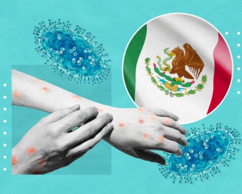 Mexico facing a new risk of health emergency due to monkeypox