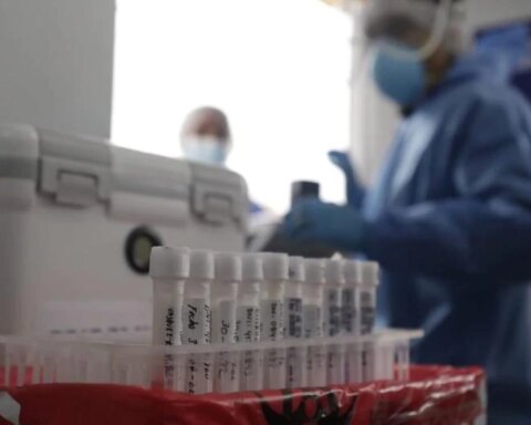 Monkeypox in Peru: cases rise to 834 and disease is reported in 15 regions