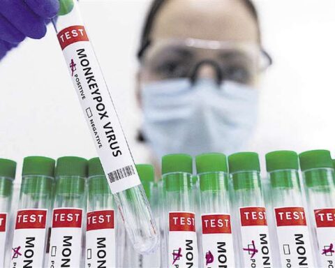 WHO urges caution after human-to-dog transmission of monkeypox