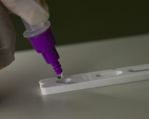 Brazil records 38 deaths and 5,300 new cases of covid-19