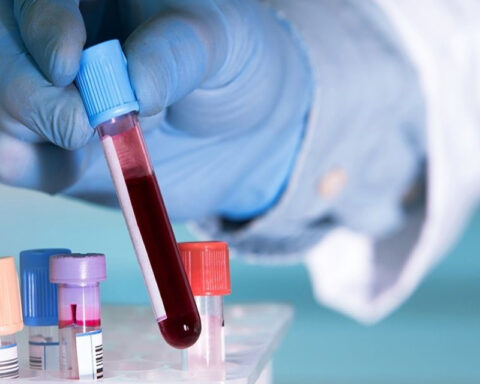 Cancer could be detected before you have symptoms with a blood test