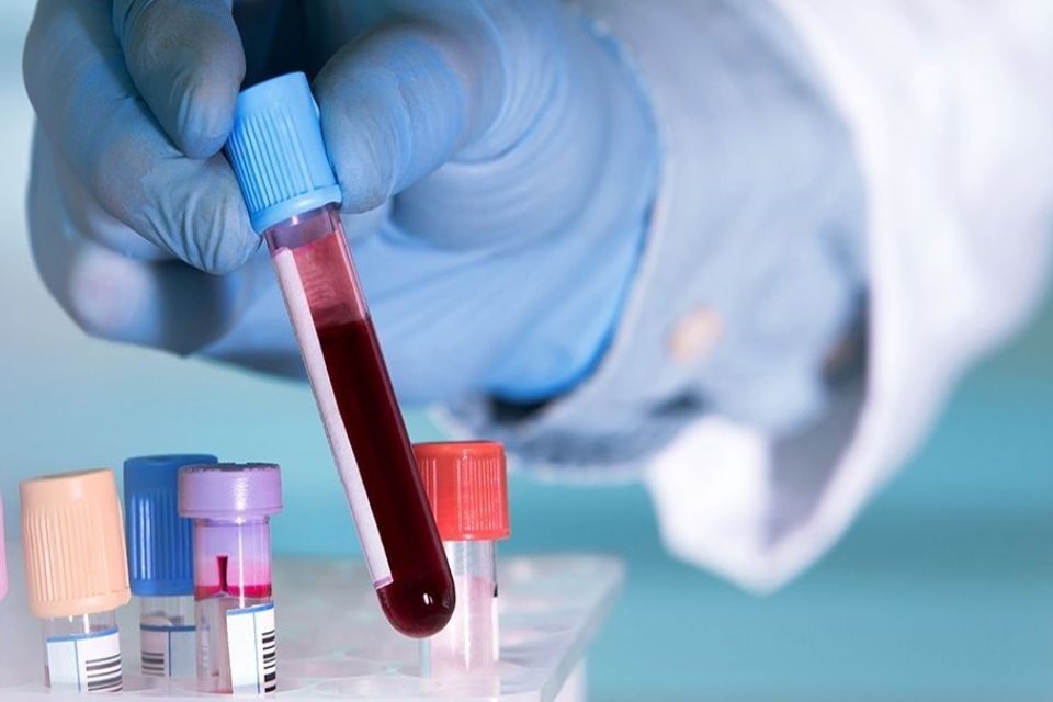 Cancer could be detected before you have symptoms with a blood test