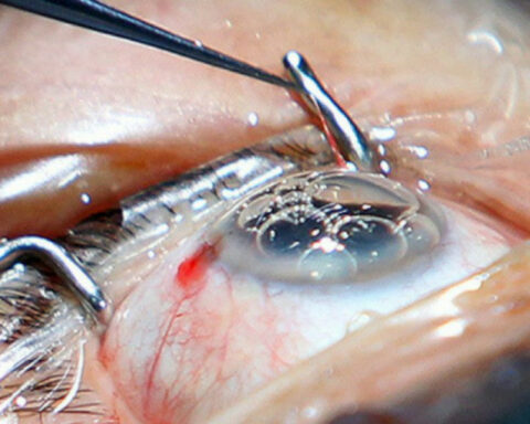 “Commodification of eye health” as the Eye Hospital works less