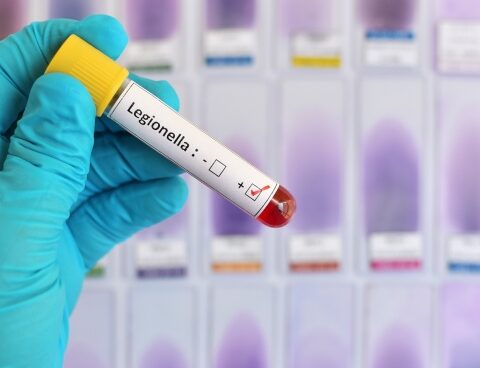 Experts continue to work in the sanatorium where the Legionella outbreak was recorded