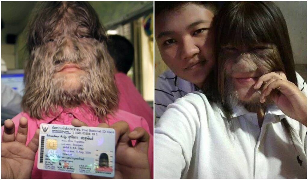 Hairiest woman on the planet fell in love, shaved and looks like this now