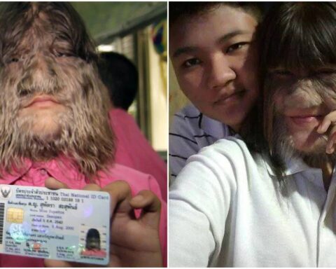 Hairiest woman on the planet fell in love, shaved and looks like this now