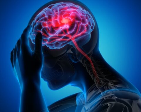 el autismo es una condición, no una enfermedad.