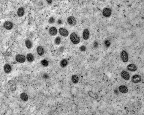 Ministry invests R$ 3 million in research on monkeypox